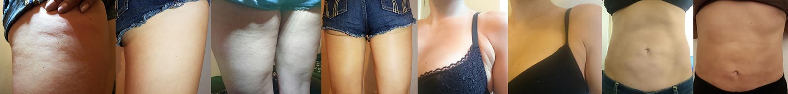 Test Byebye Cellulite Von Dr Juchheim Cosmetics Cellulite Killer Oder Bloss Fake Die Beautybloggerin